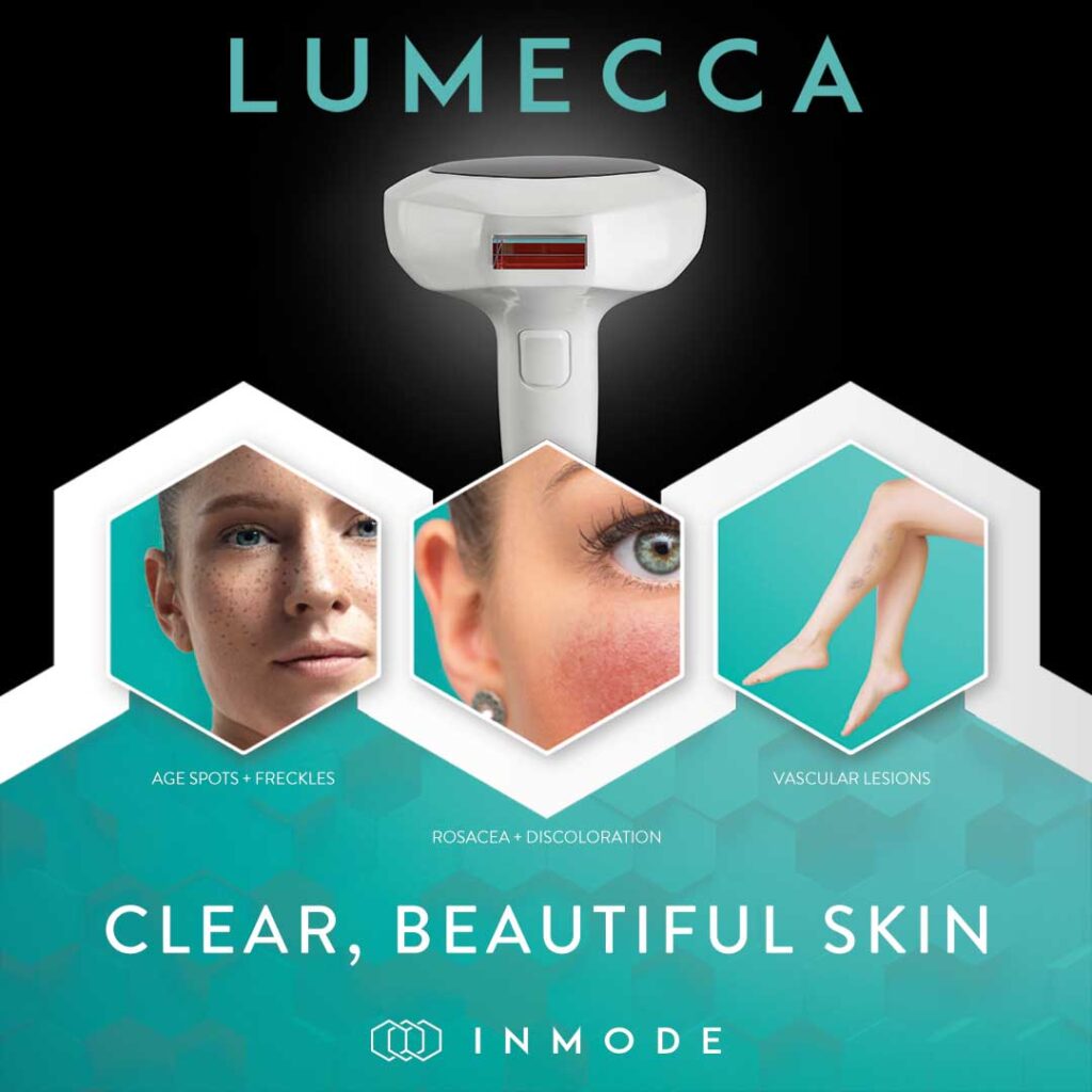 lumecca-treatment-area-instagram-post-preview-1-copy.jpg